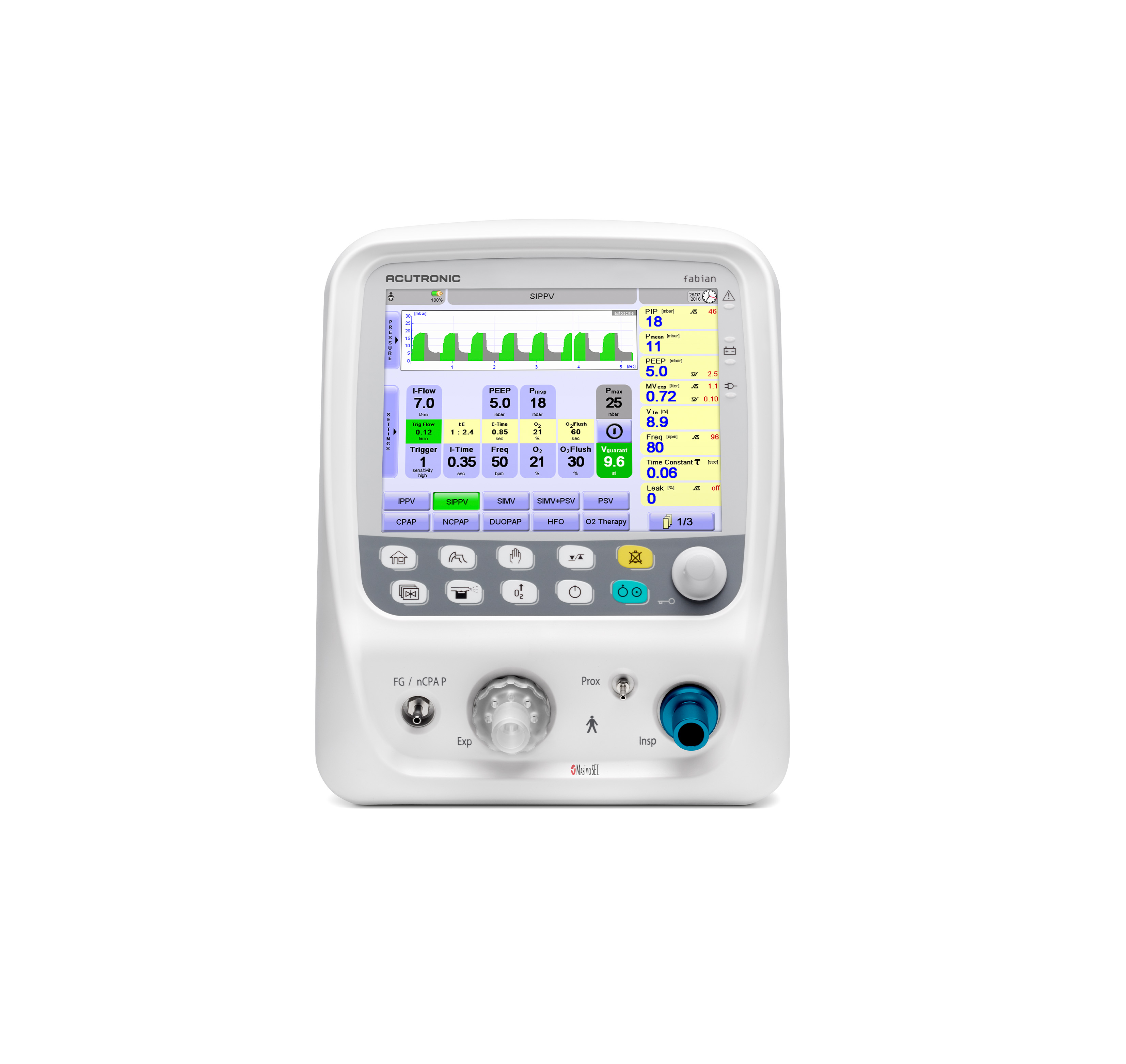 Fabian HFO Ventilator