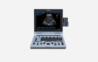 Portable colour doppler U60