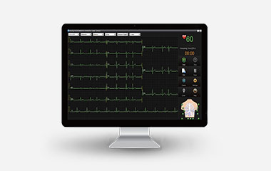 Resting ECG SE-1515