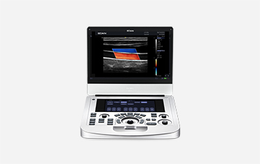 Portable colour doppler Acclarix AX3