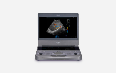 Portable colour doppler Acclarix AX8