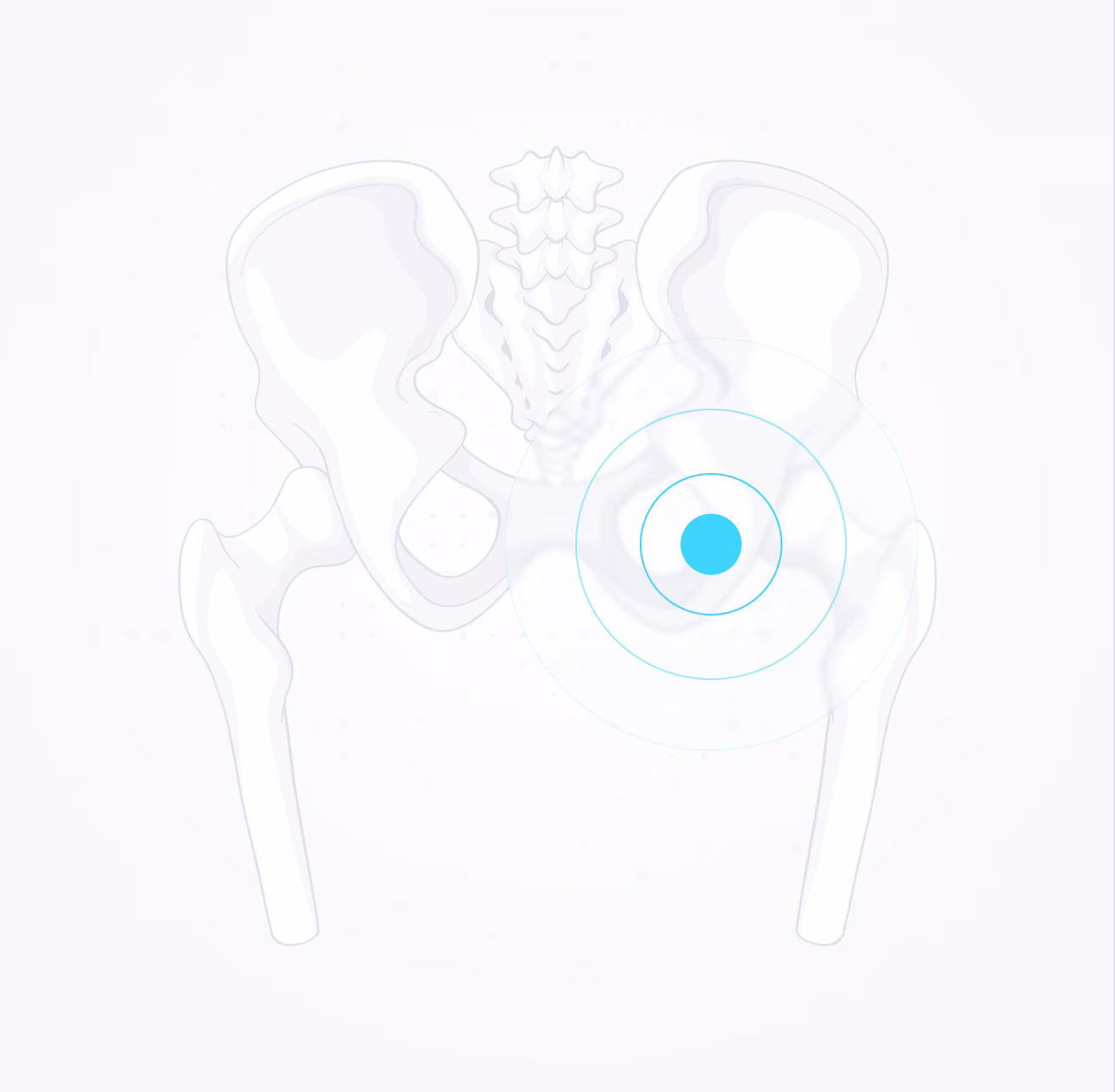 Skeleton illustration highlighting the right hip joint with blue concentric circles indicating pain or focus.