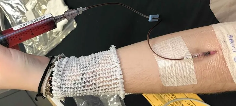 Bras avec une prise de sang, peur des aiguilles