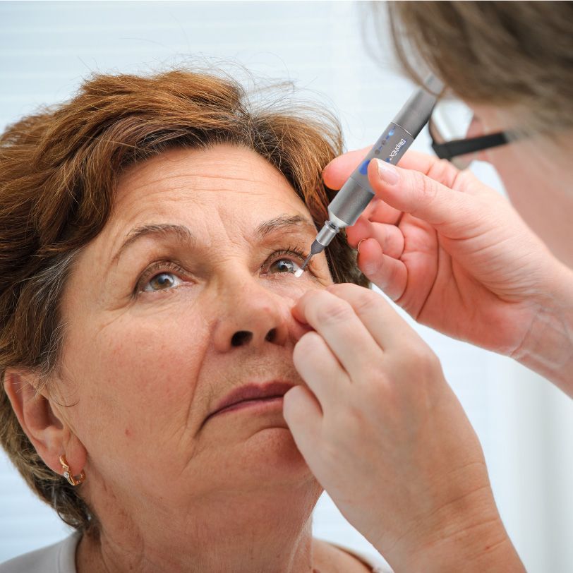 Optometrist using the BlephEx handpiece to exfoliate a patient's lower lid margin