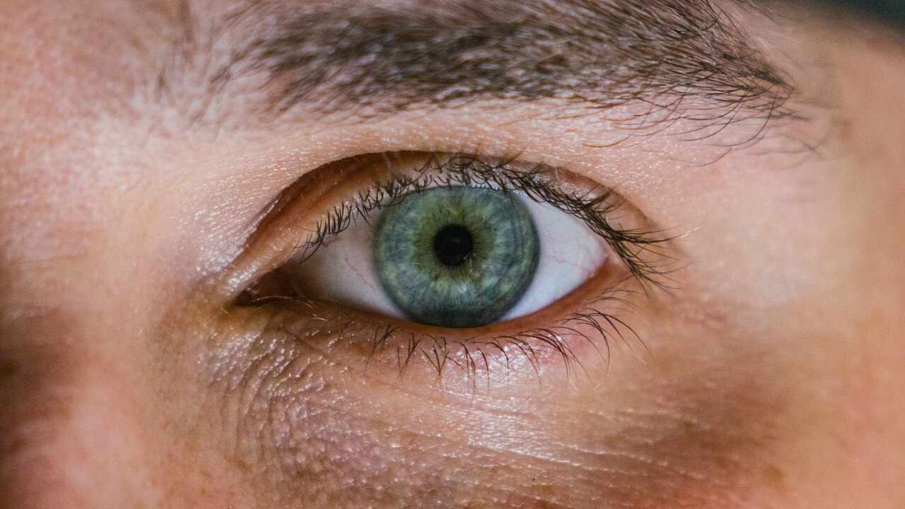 Close-up of an eye showing the eyelid margins and lashes