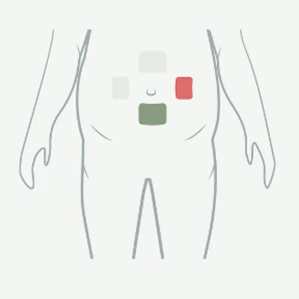 Scherm in de app waarop je aangeeft waar je de injectie hebt gezet.
