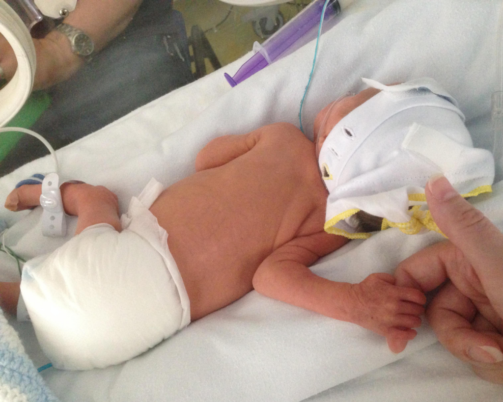 Preemie Development
