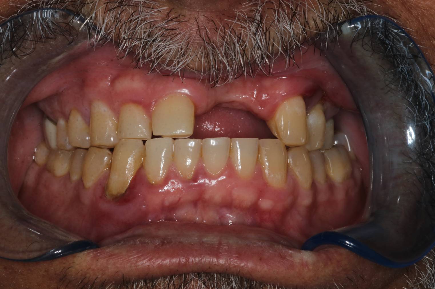 Before Image