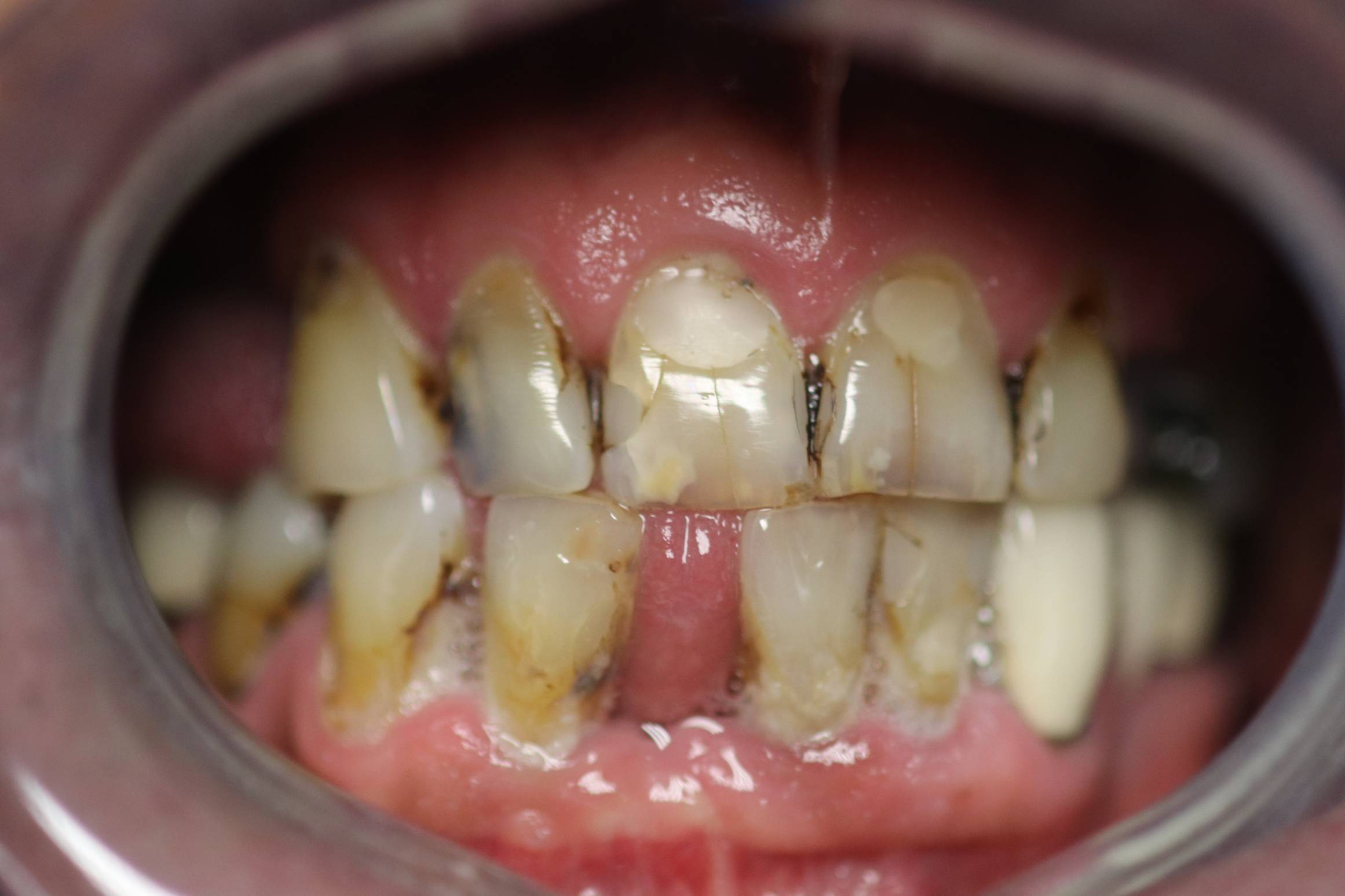 Before Image