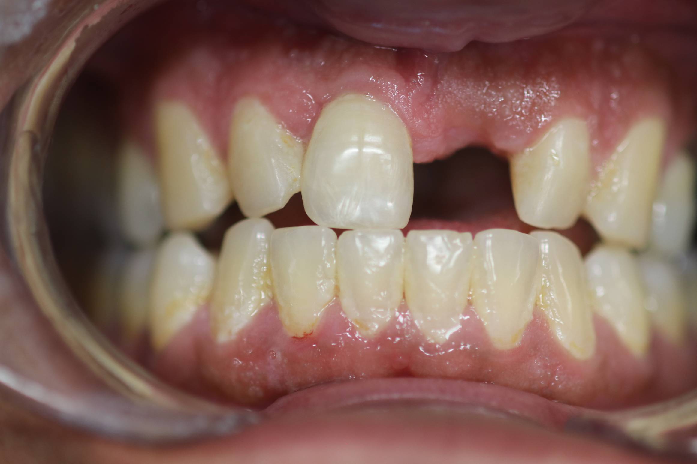 Before Image