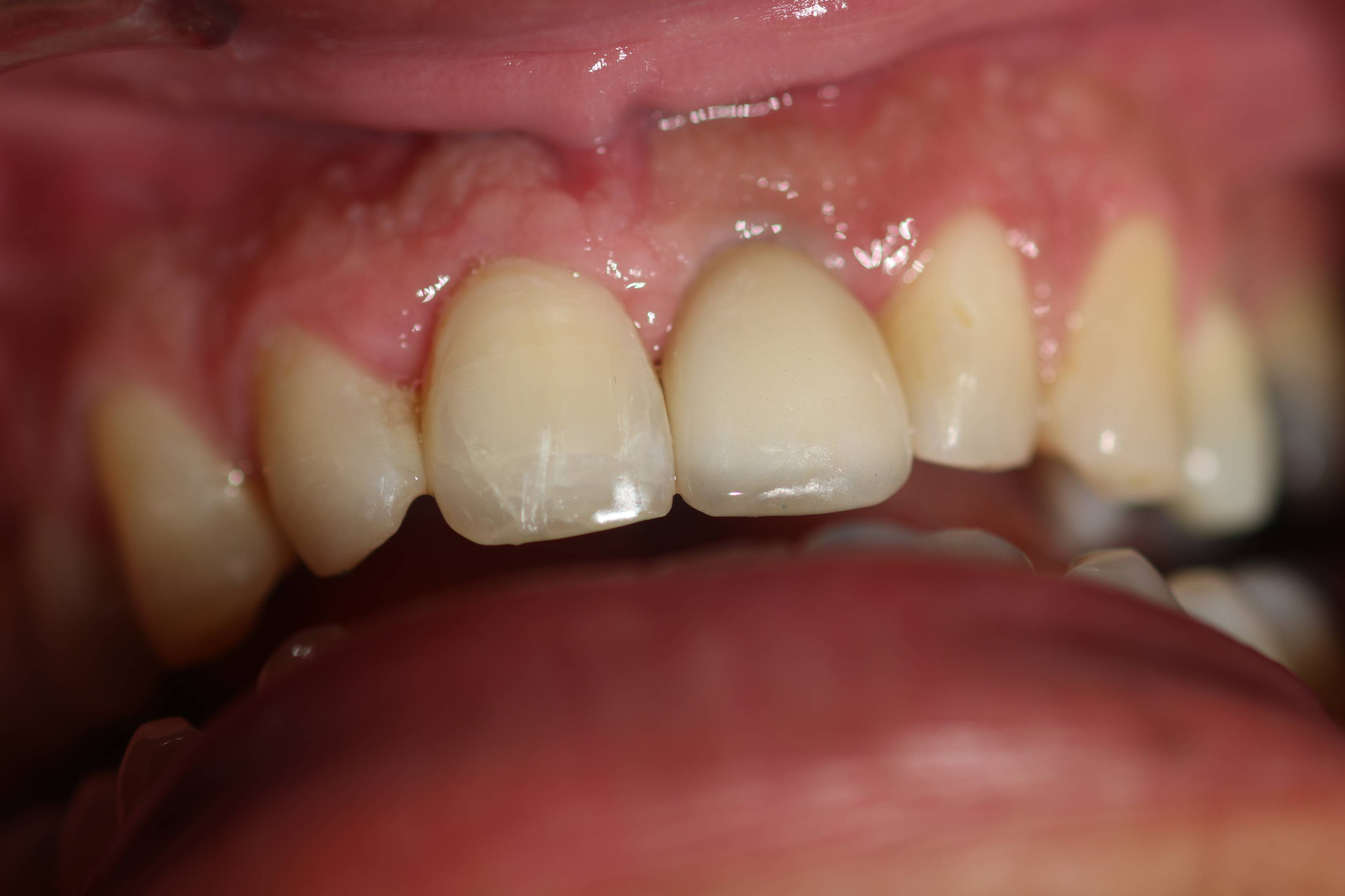 After Image