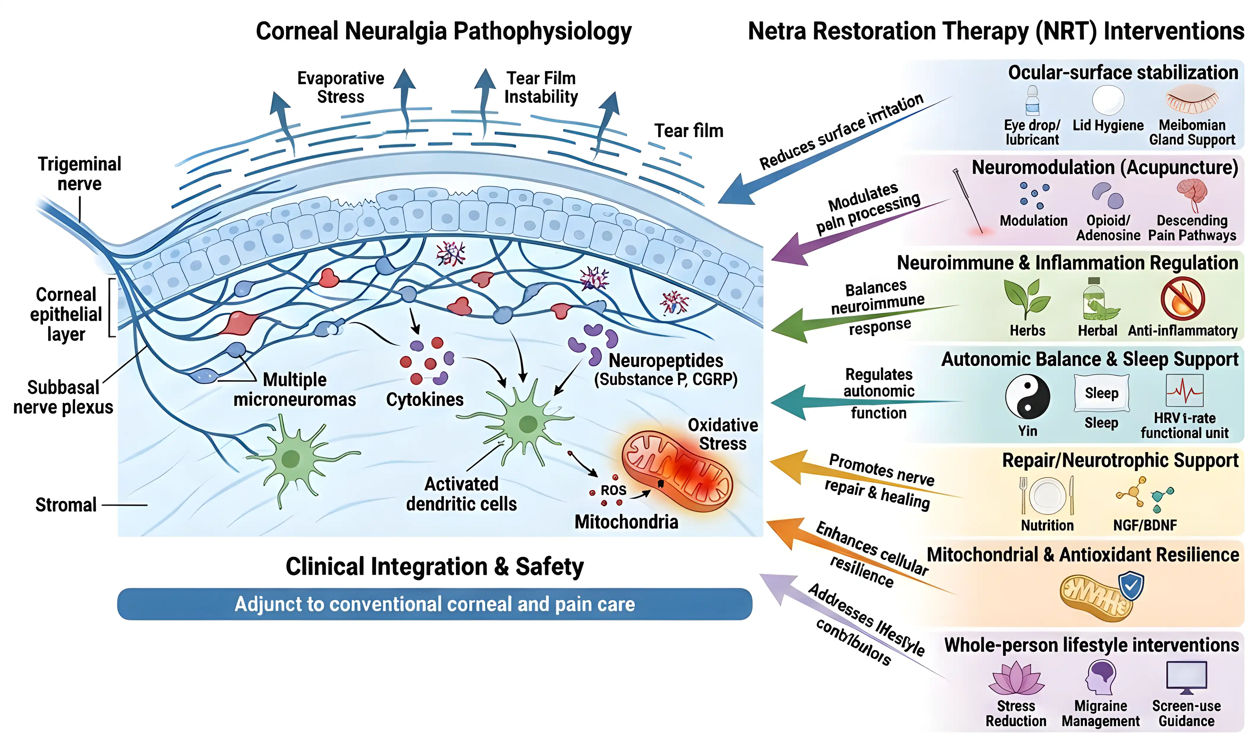 Diagram of Netra Restoration Therapy interventions supporting corneal neuralgia care