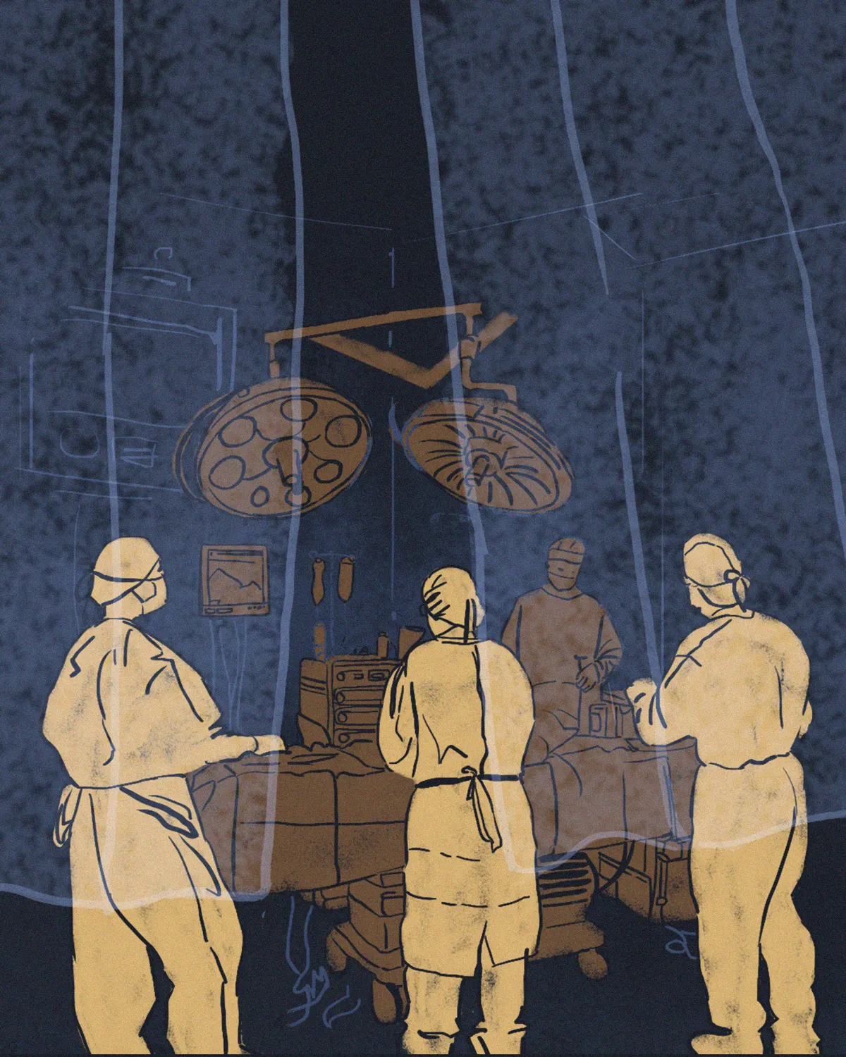 Illustration of four medical professionals in surgical gowns and masks performing an operation around a patient on an operating table under two large surgical lights in a dark operating room.