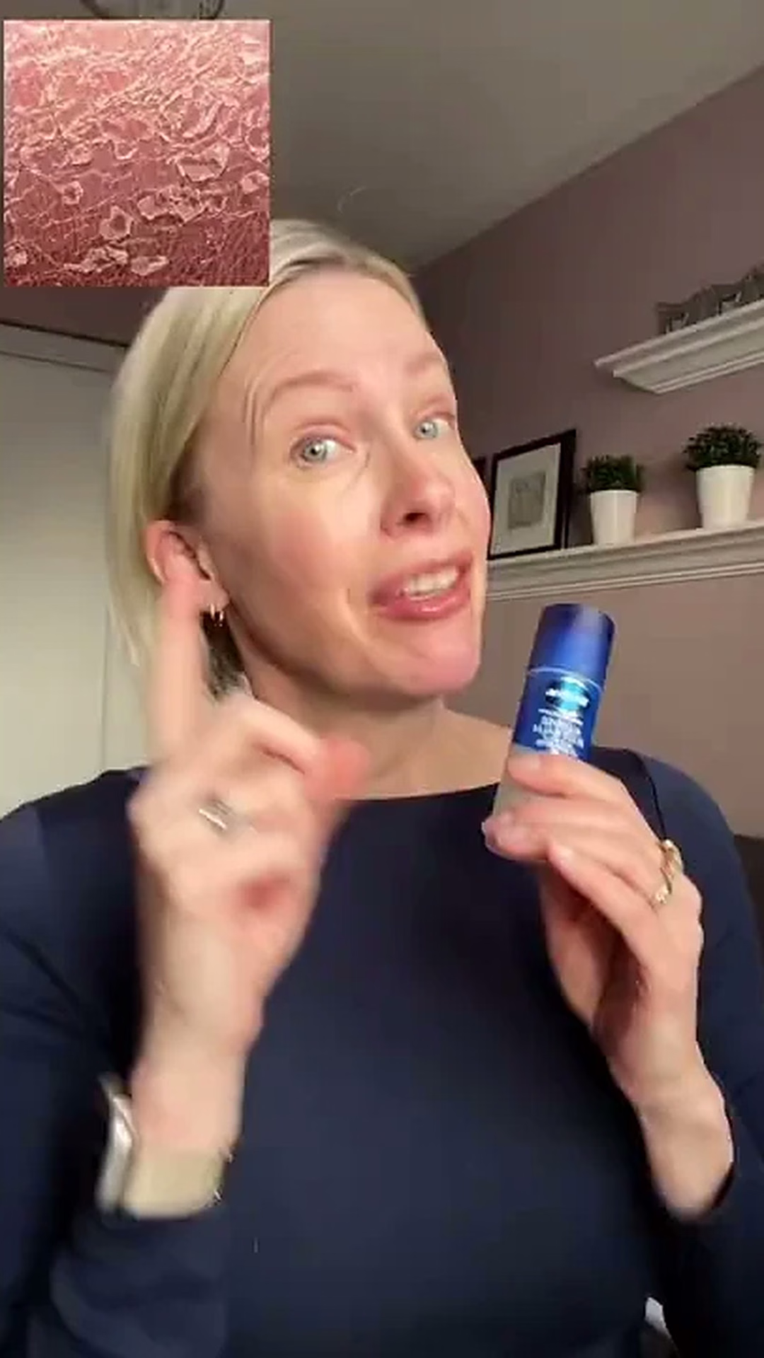 Vaseline: Slugging