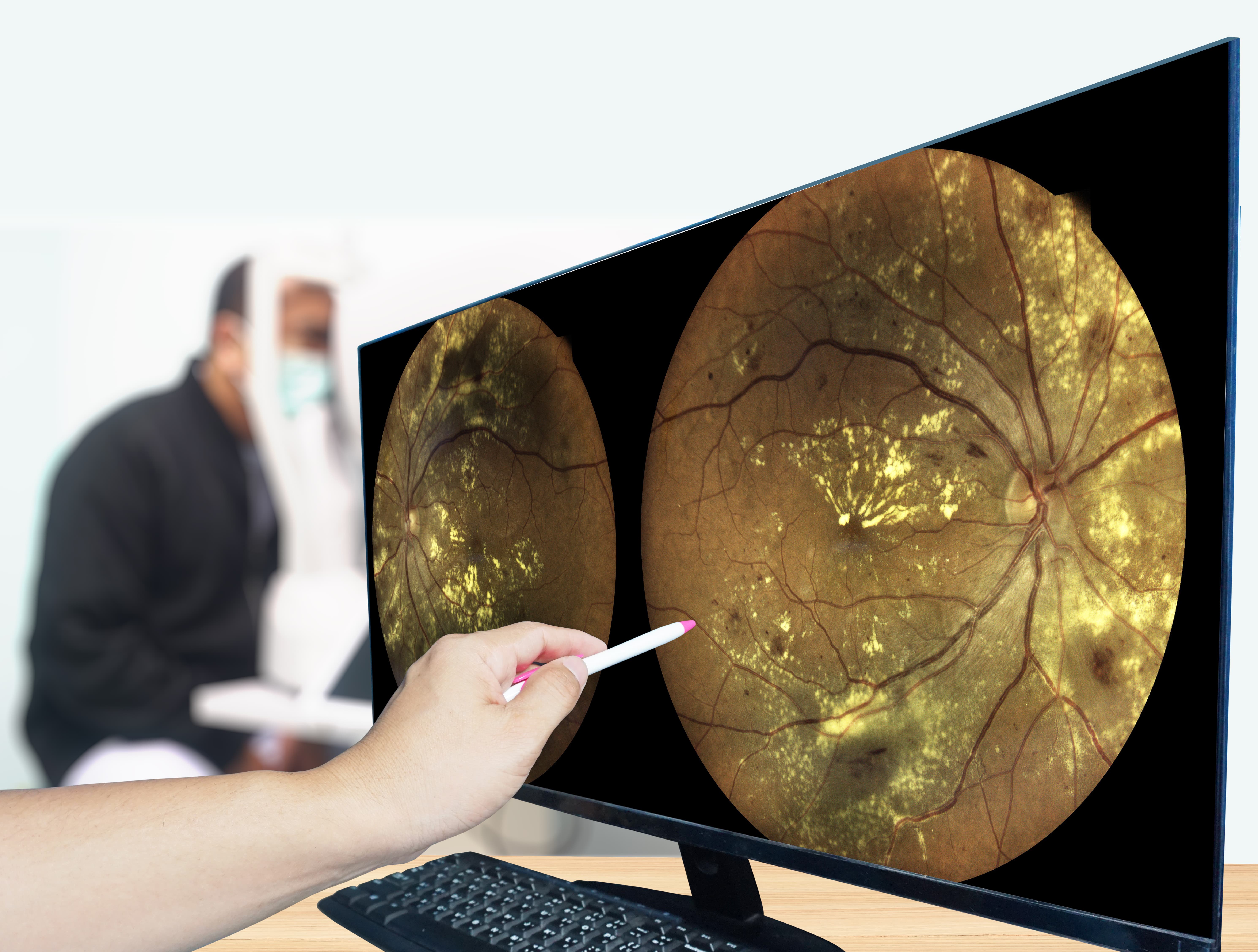 OCT scan showing the retinal layers during an eye exam