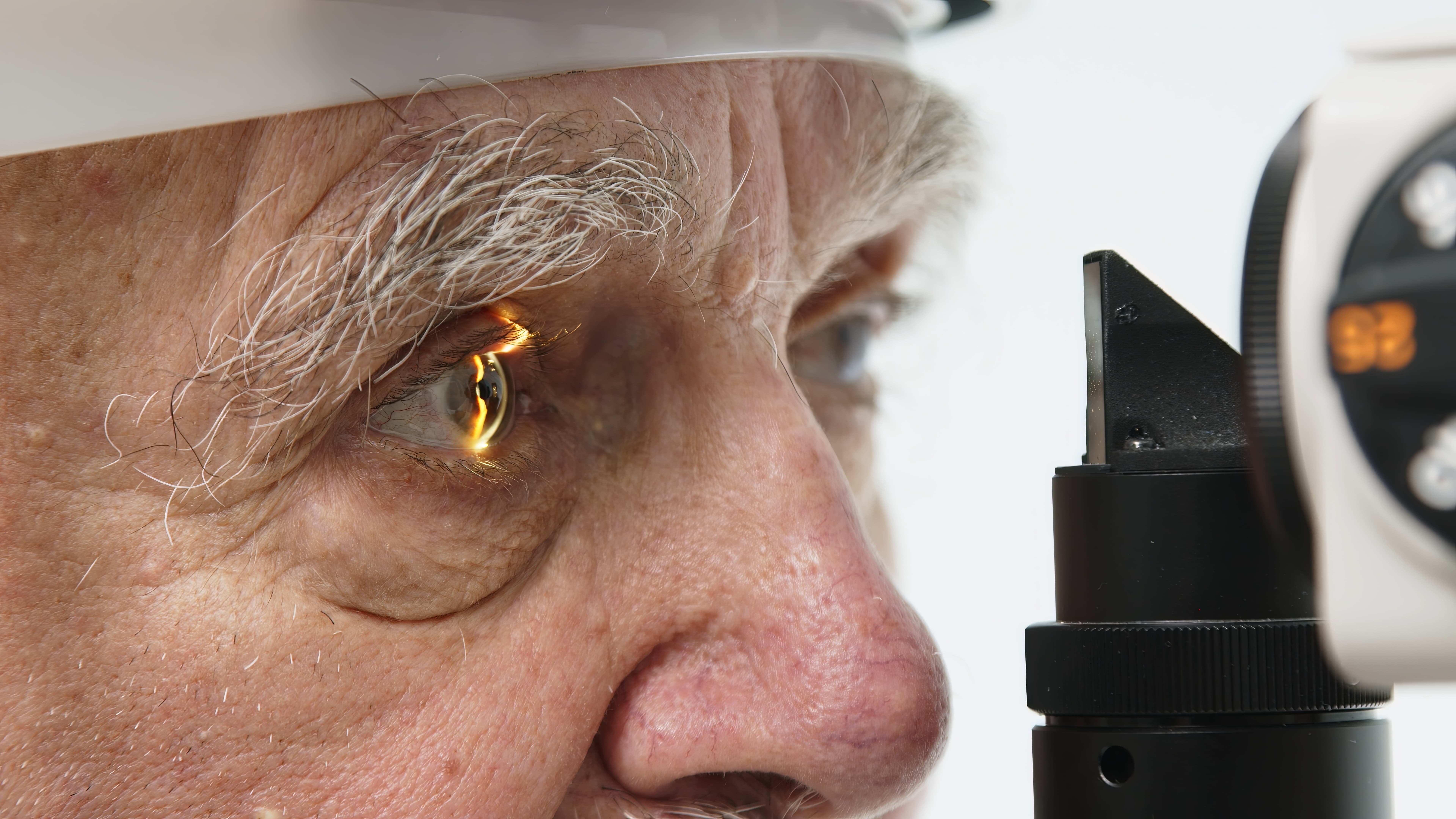Meibography imaging of the meibomian glands during a dry eye exam