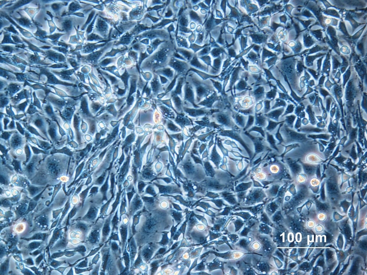Phase-contrast micrograph of adherent CHO cells at 100 micrometre scale