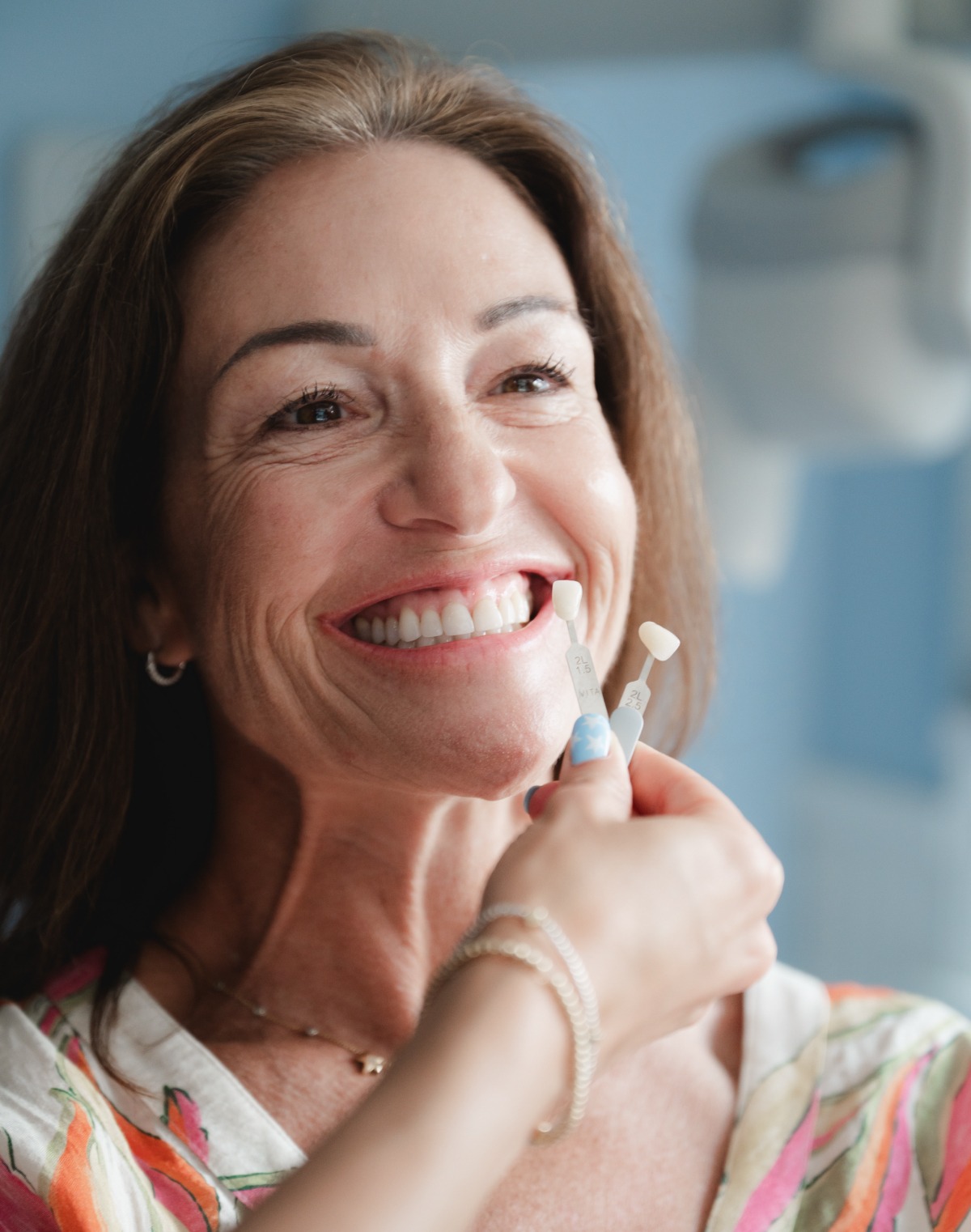 Woman smiling while a dental professional shades matching with two tooth color samples.