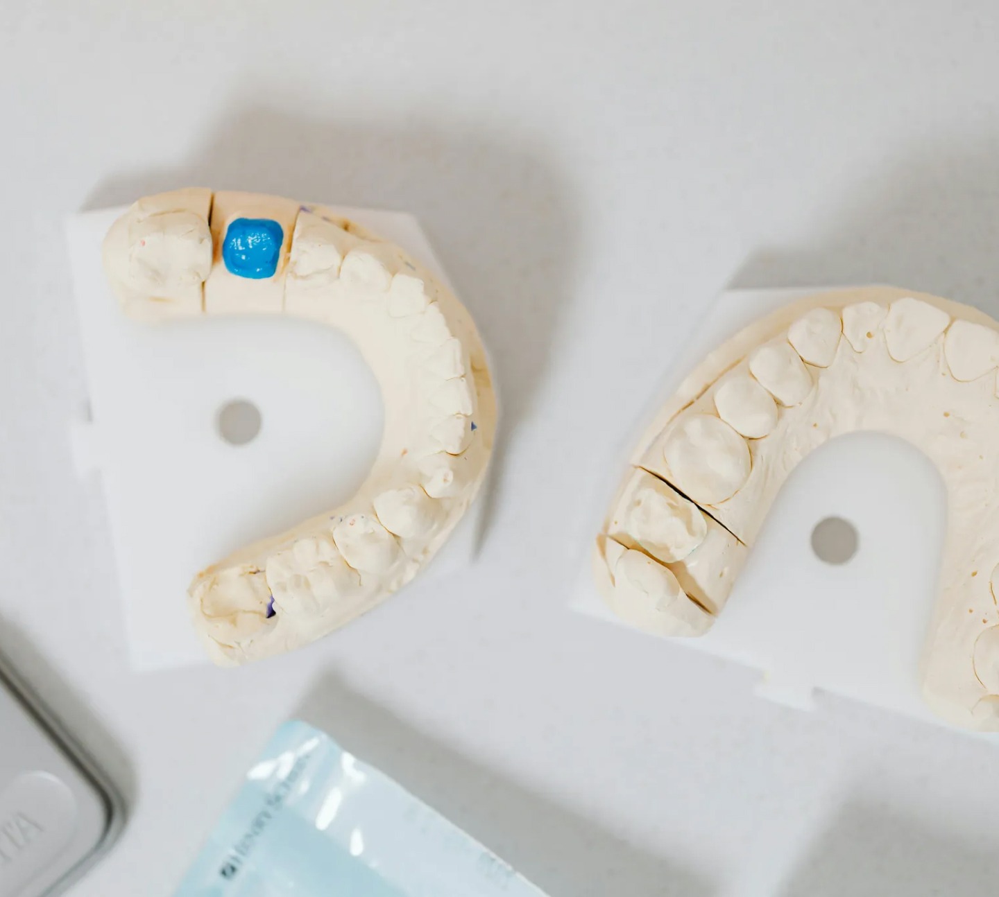Two dental molds of upper teeth on a white surface, one with a blue-marked tooth.
