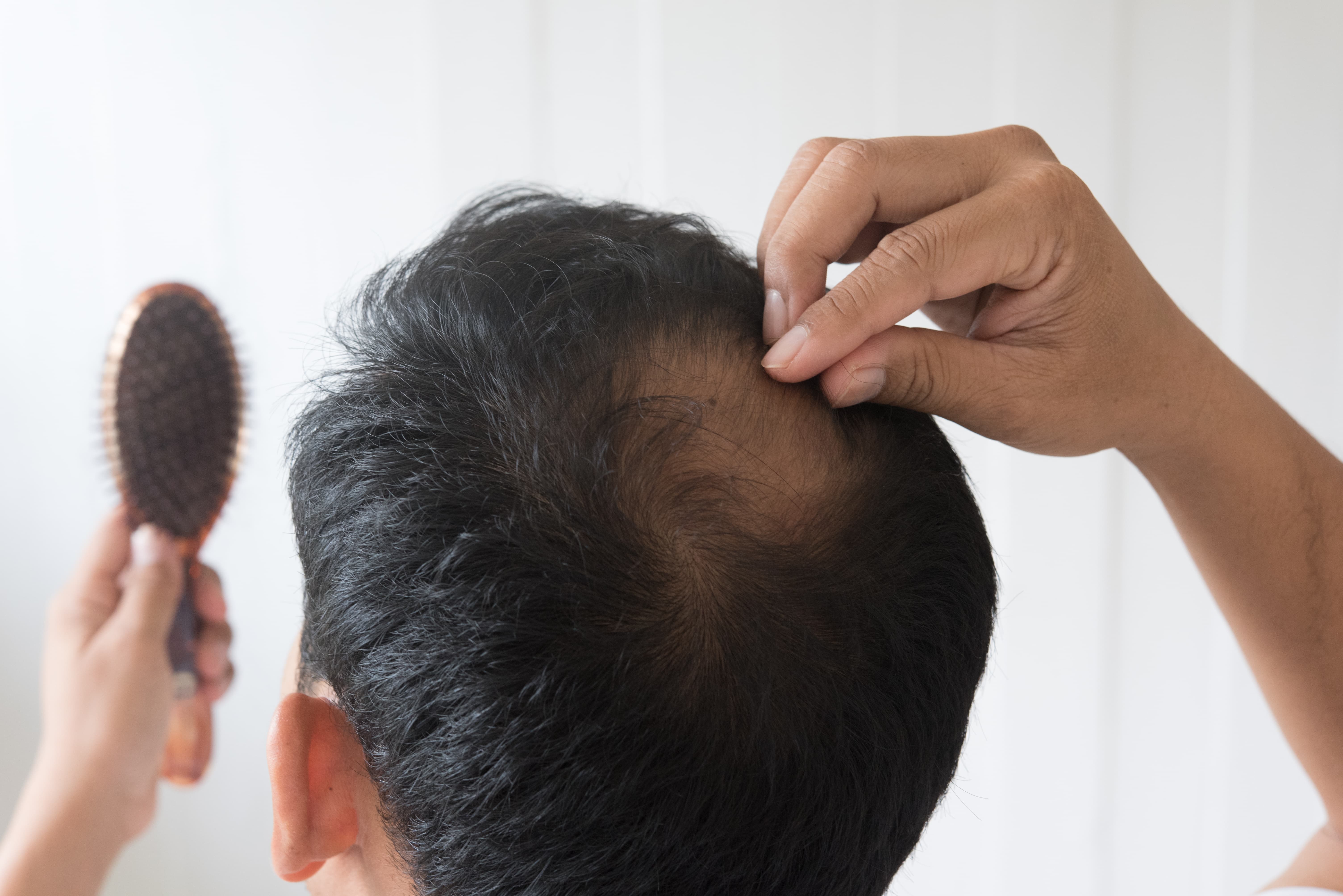 Scalp treatment illustrating needle-free Alma TED hair restoration