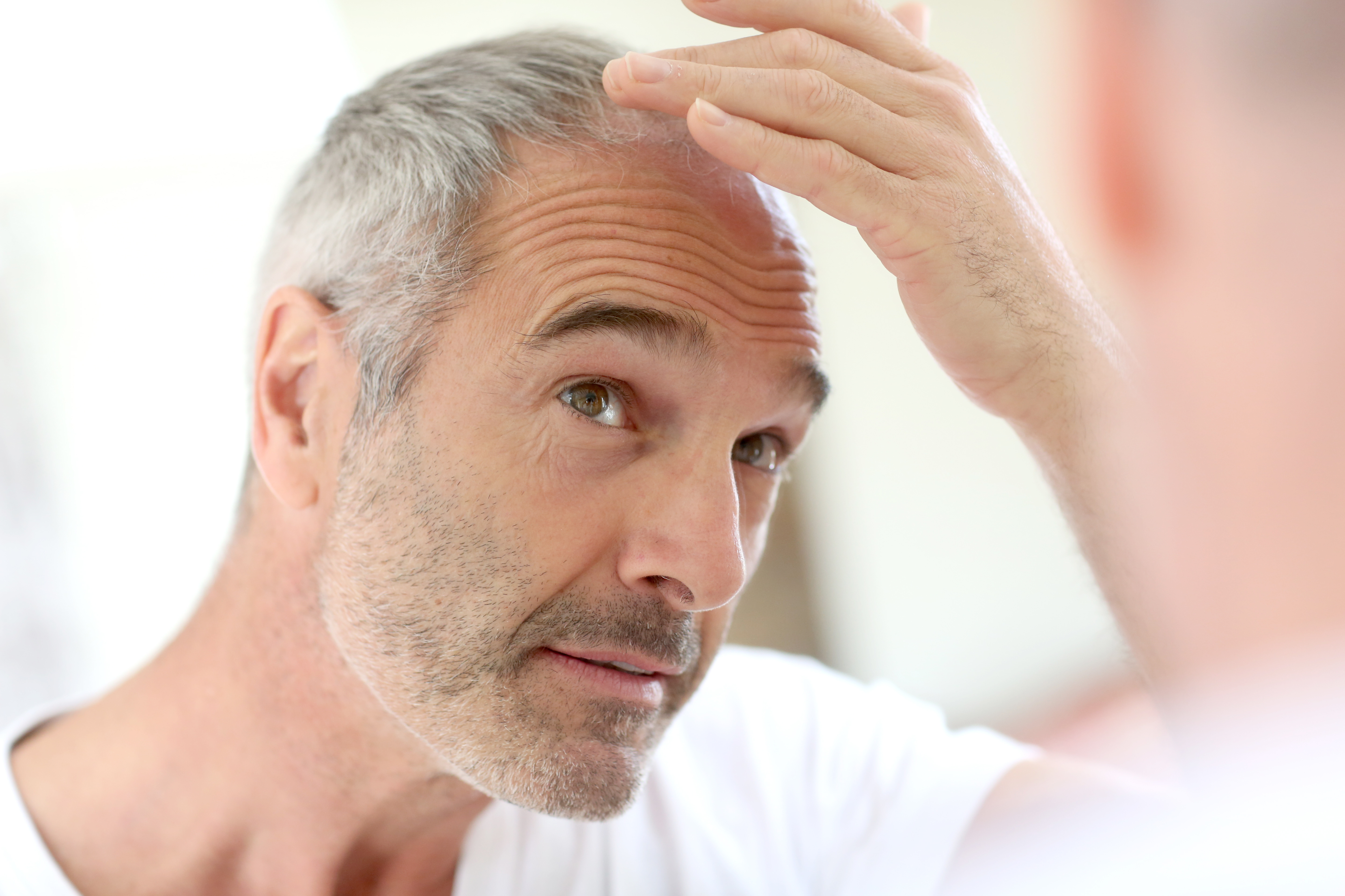 Close-up of hair and scalp illustrating the connection between inflammation and hair loss