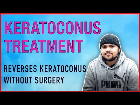Keratoconus & Myopia: Meet Veeral