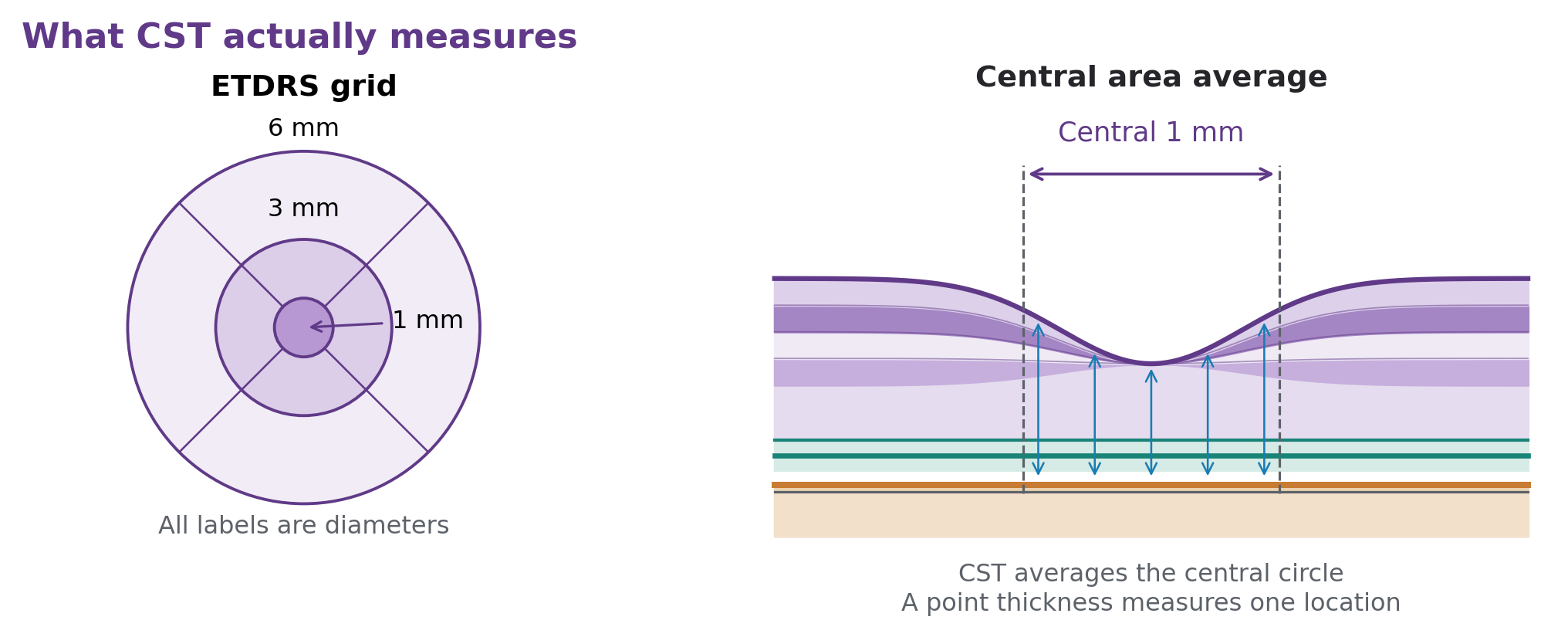 ETDRS map with a highlighted central 1-mm circle, paired with a foveal cross-section showing multiple thickness measurements.