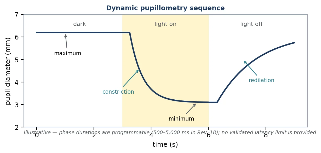 Figure 17 A dynamic pupillometry sequence with constriction and redilation annotated. Illustrative; no validated CA-800 latency or velocity limit was verified.