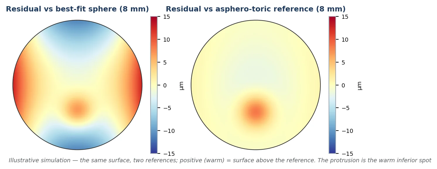 Figure 10 One simulated surface — regular toricity, mild asphericity and a small focal protrusion — fitted against a best-fit sphere (left) and an asphero-toric reference (right) over 8 mm. Positive (warm) values are surface above the reference, so the protrusion appears as the warm inferior spot. The spherical fit leaves the toricity as a bow-tie residual that hides it; the asphero-toric fit exposes it. Same eye, same scan. Illustrative simulation.
