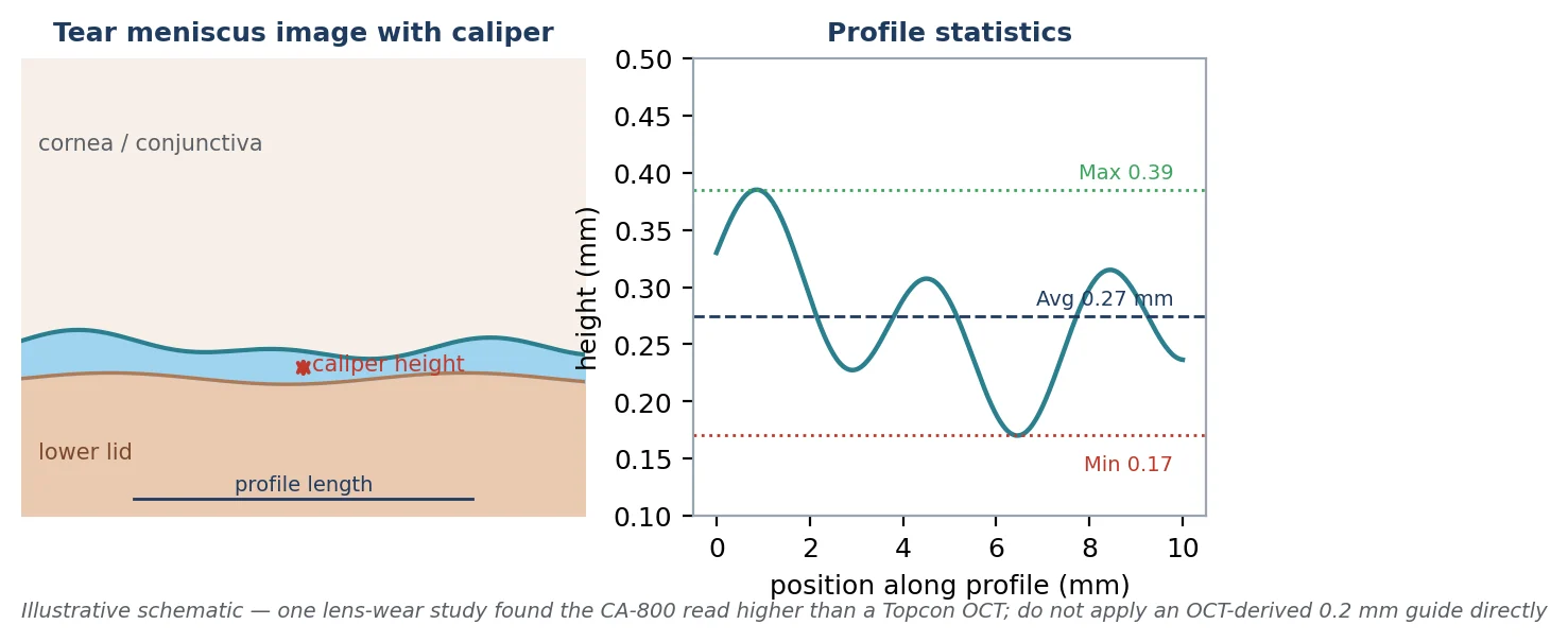 Figure 25 Tear meniscus caliper and profile statistics. Illustrative schematic; in the one published comparison the CA-800 read higher than a Topcon OCT.