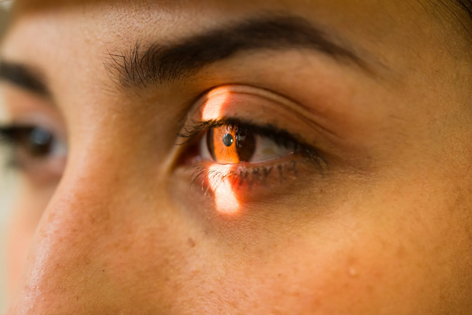 Can Dry Eyes Be Cured Permanently?