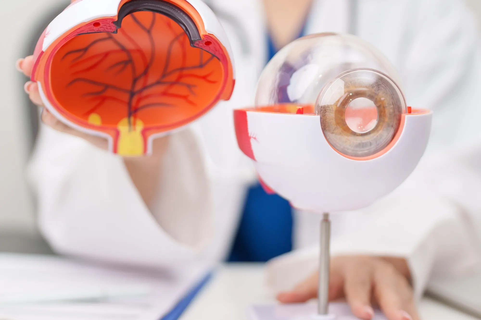 Glaucoma vs Cataracts: Differences, Symptoms, Treatment and Having Both