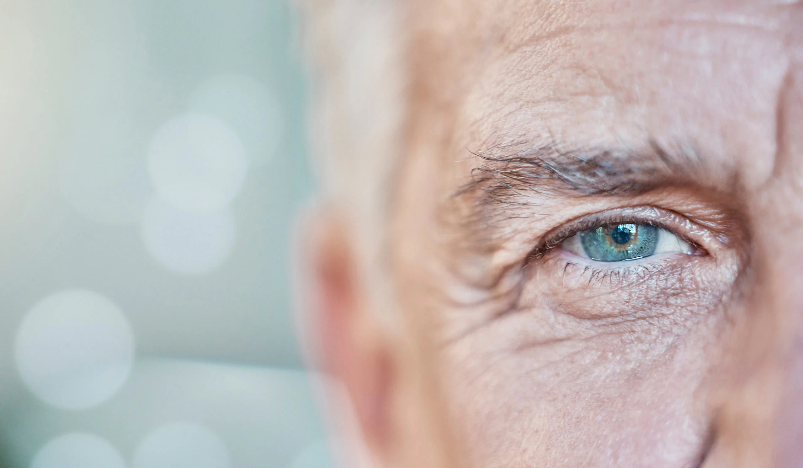 Conjunctivochalasis: When Loose Eye-Surface Tissue Mimics Dry Eye