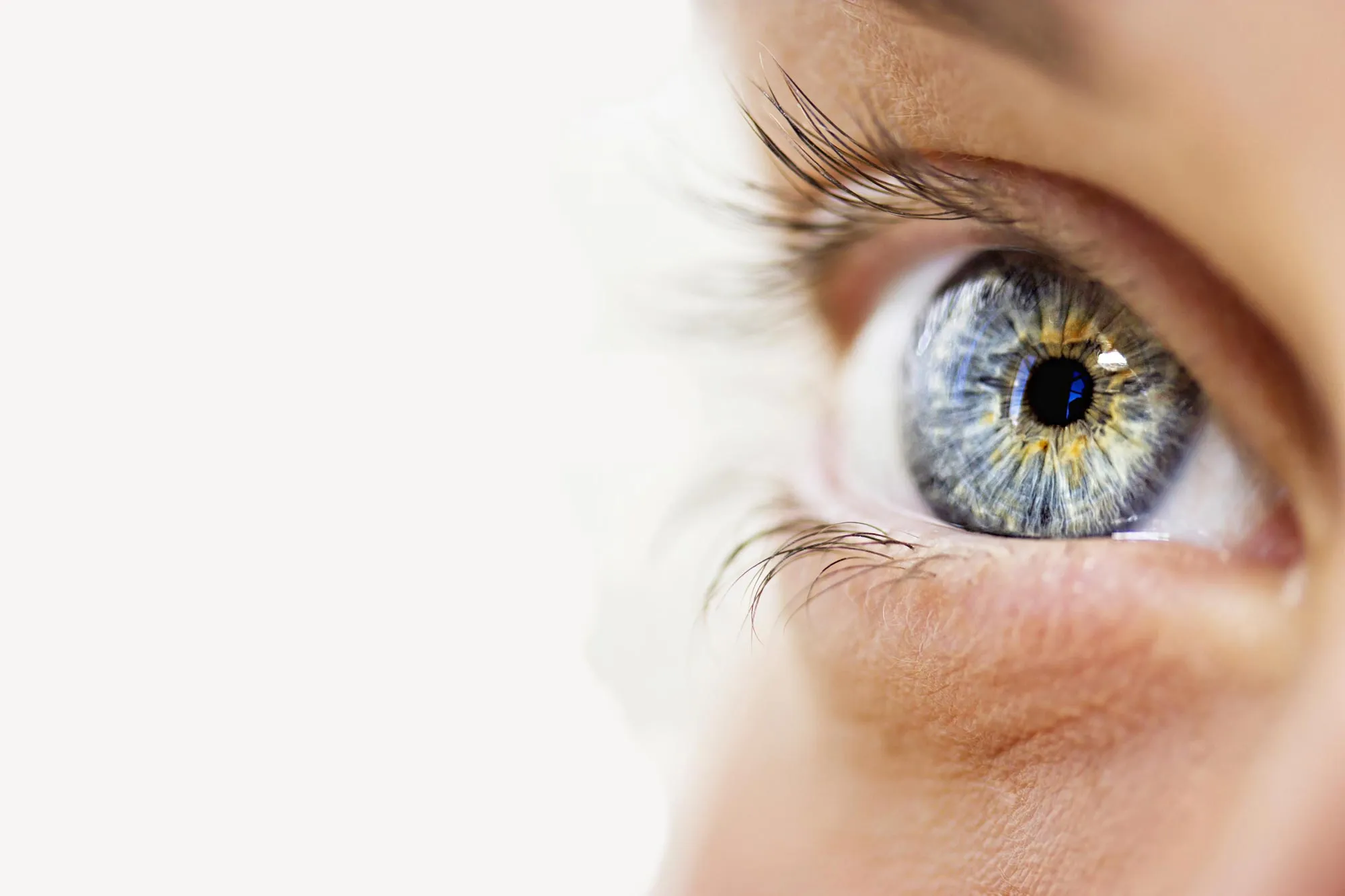 Scleral Lenses: Who They Help, Fitting, Daily Care, and Limits