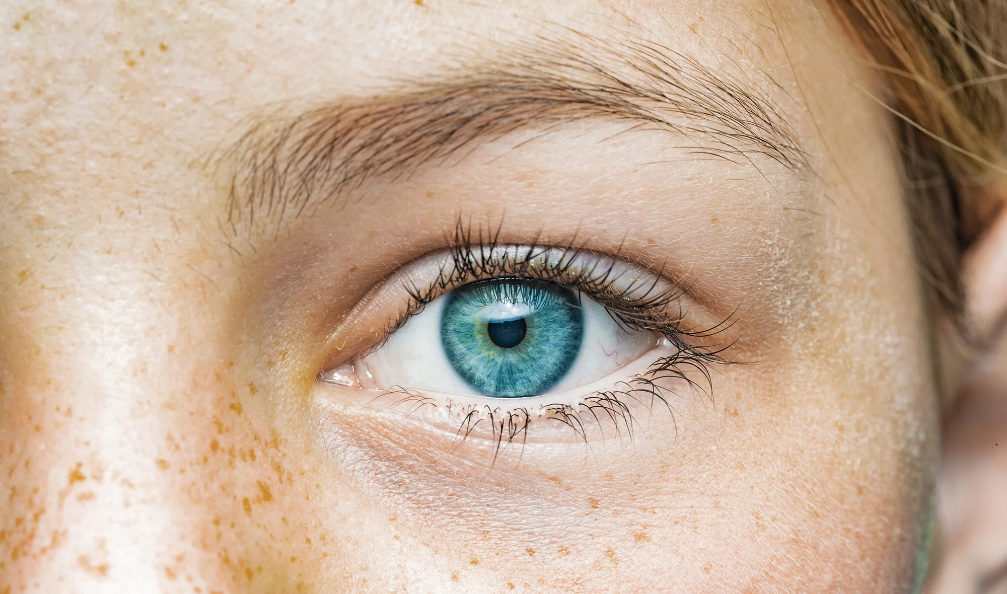 Trichiasis (Ingrown Eyelash): Symptoms, Causes and Treatment