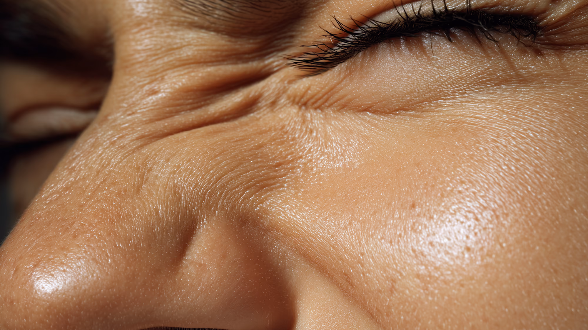 Photo of a young person with small wrinkles.