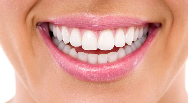 After: whitening case 2