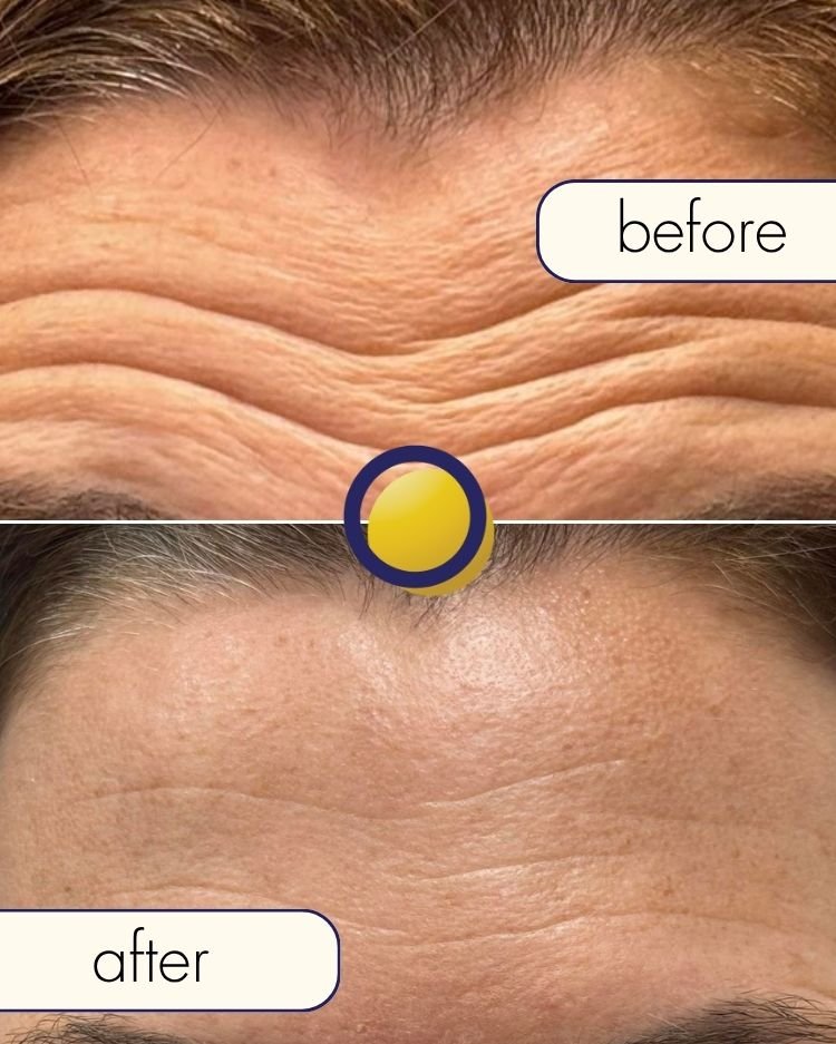 Before treatment photograph