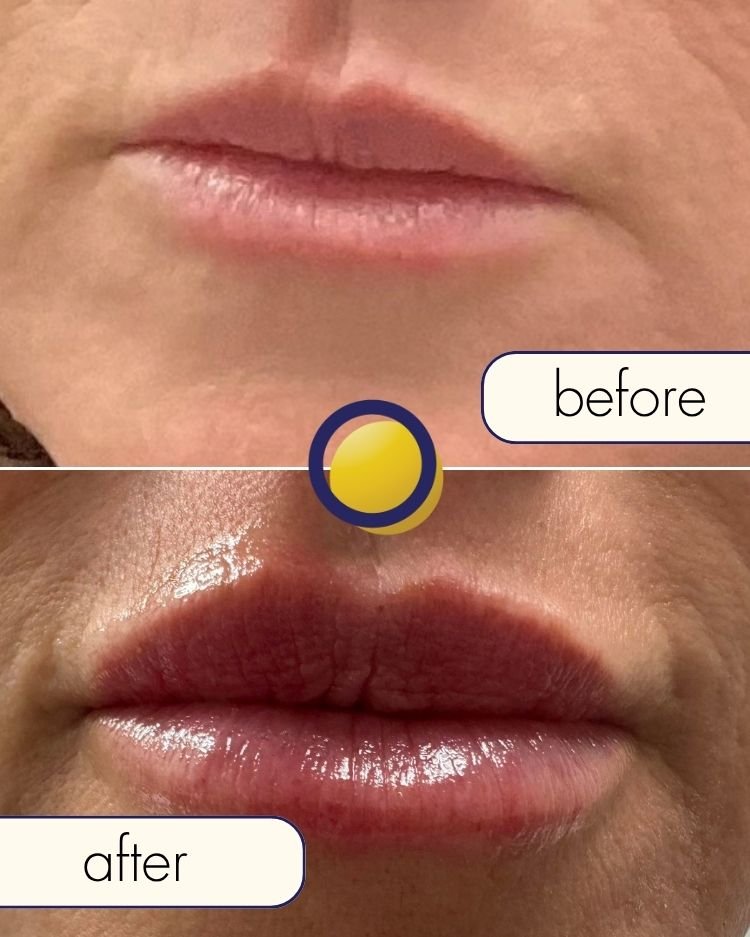 Before treatment photograph