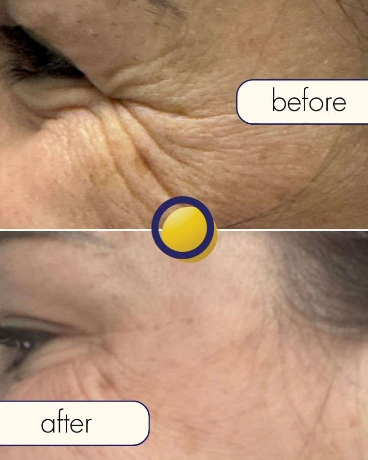 Before treatment photograph