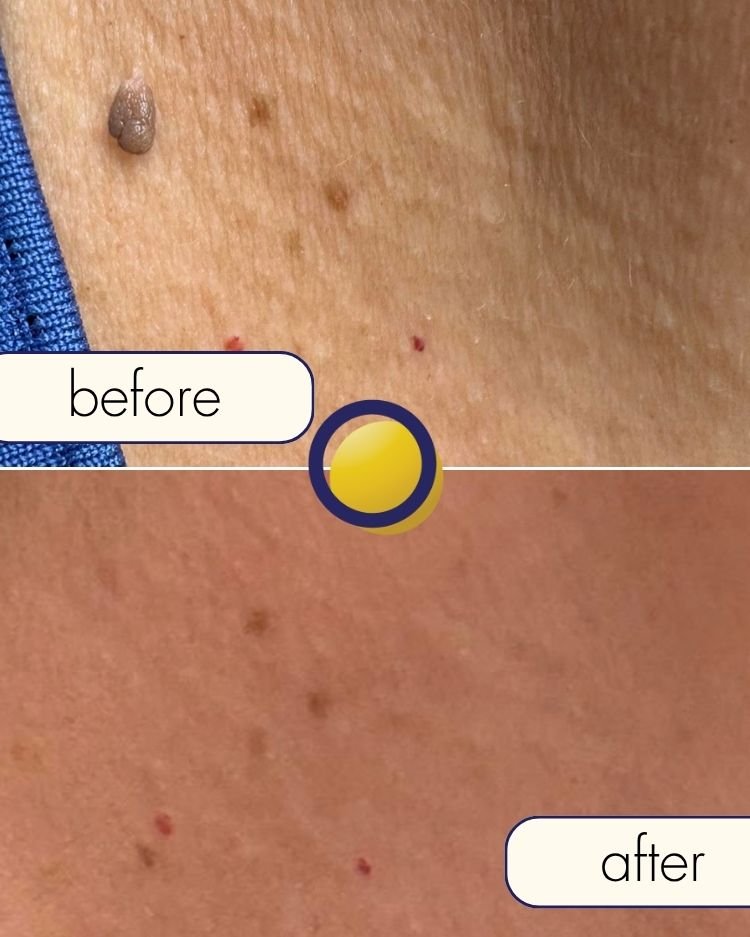 Before treatment photograph