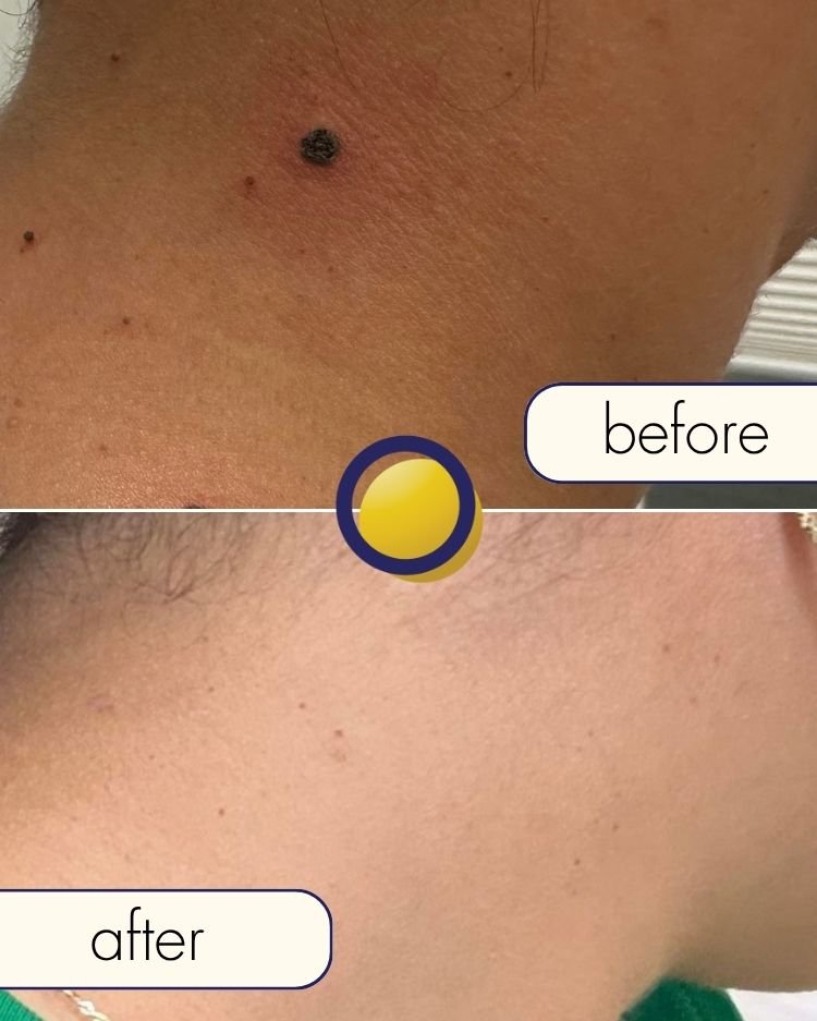 Before treatment photograph