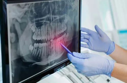 Dentist reviewing a panoramic dental X-ray on a lightbox