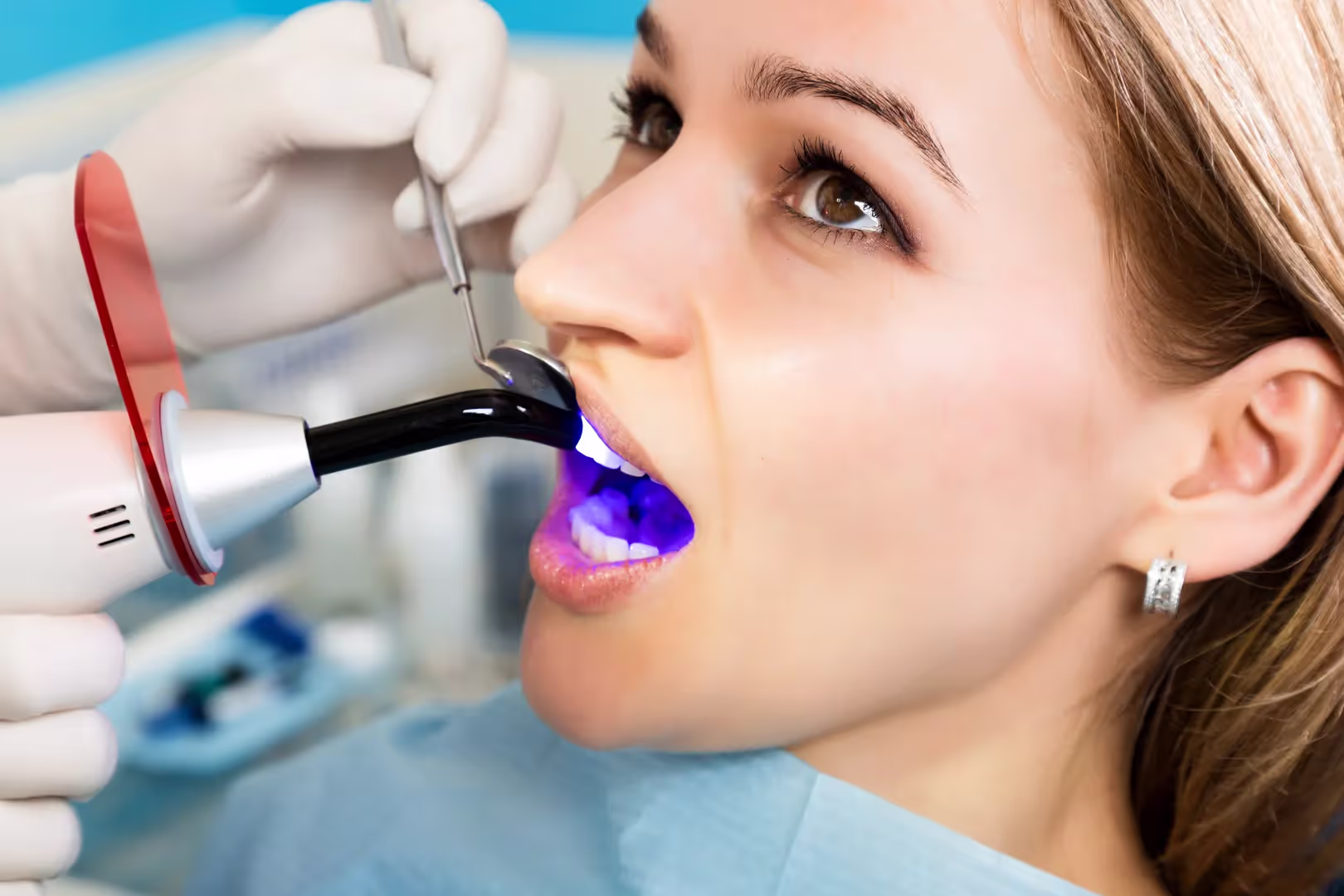 Dental Bonding in Durham, NC