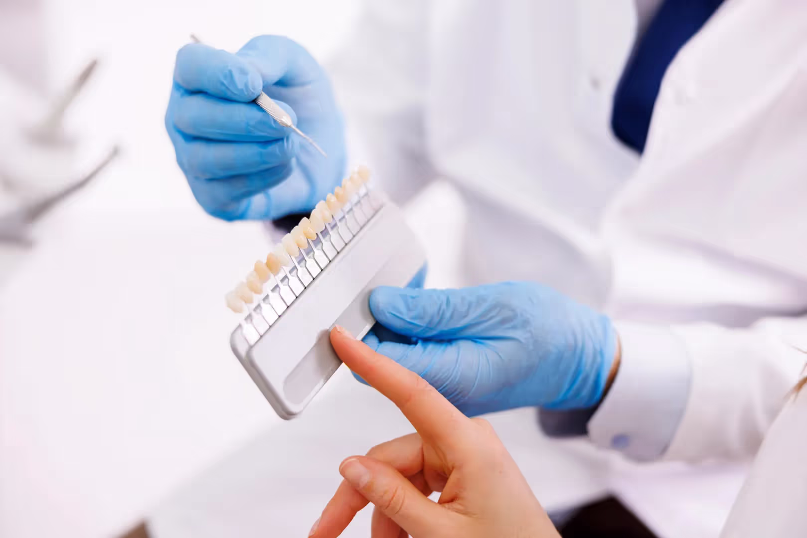 What Are Porcelain Veneers?