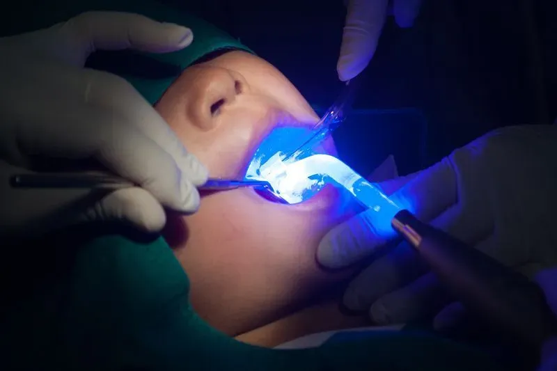 Prevent Cavities with Protective Dental Sealants