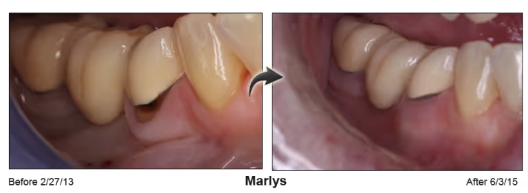 Marlys2