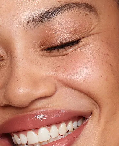Close-up of a smiling face with closed eyes, freckles, and glossy lips.