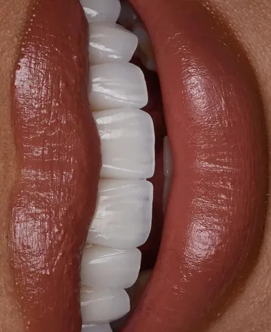 Close-up of glossy brown lips slightly open showing white, clean teeth.