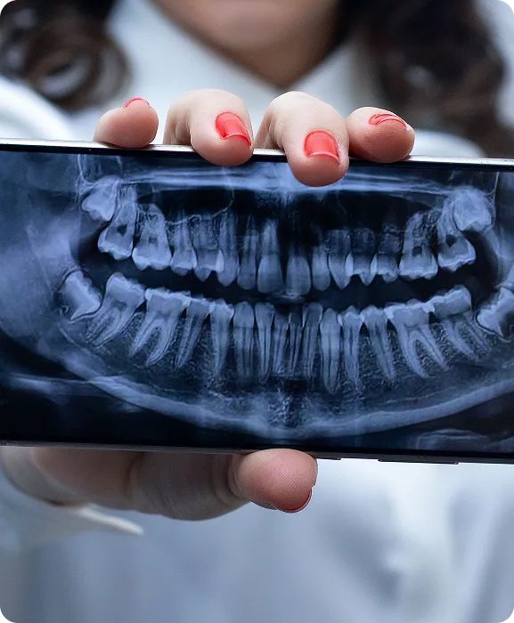Person holding a smartphone displaying a dental X-ray image of teeth and jaw.